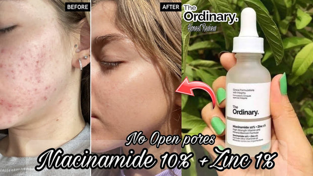 The Ordinary Niacinamide 10% +Zinc 1% Regular